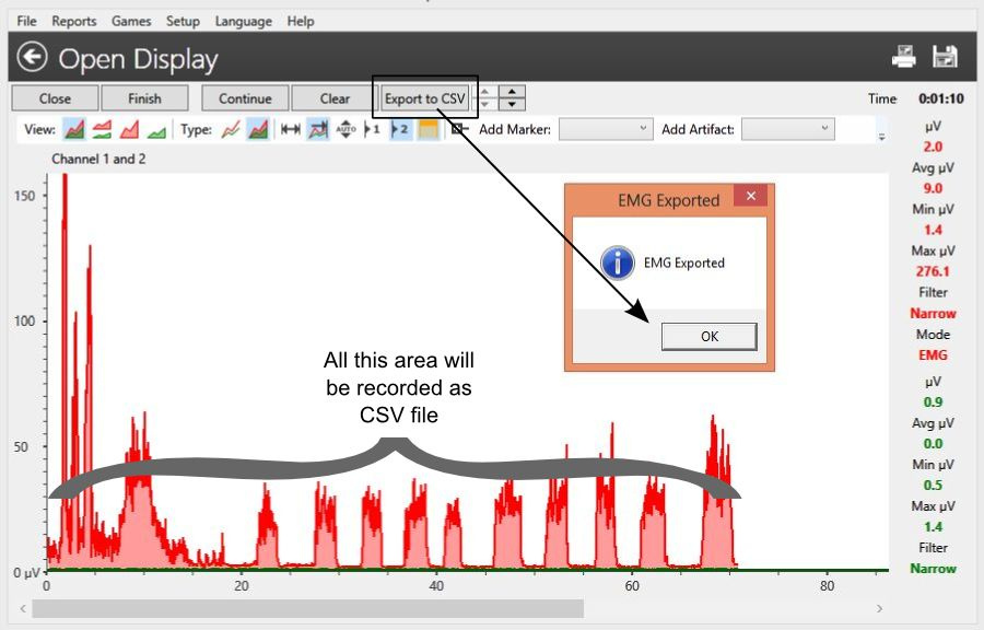 eksportowanie surowych danych EMG z oprogramowania NeuroTrac software do pliku CSV