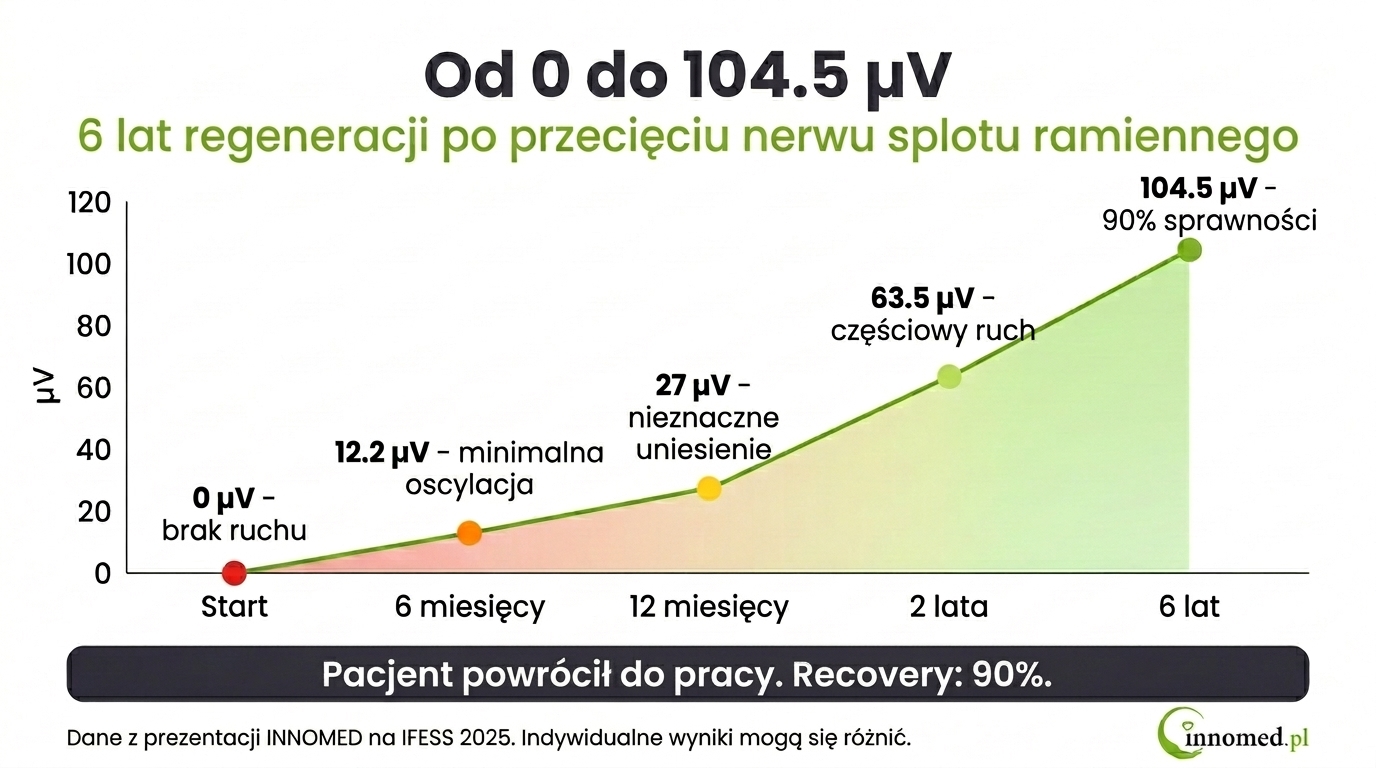 Infografika: regeneracja nerwu splotu ramiennego - od 0 do 104,5 µV w ciągu 6 lat terapii z monitorowaniem sEMG