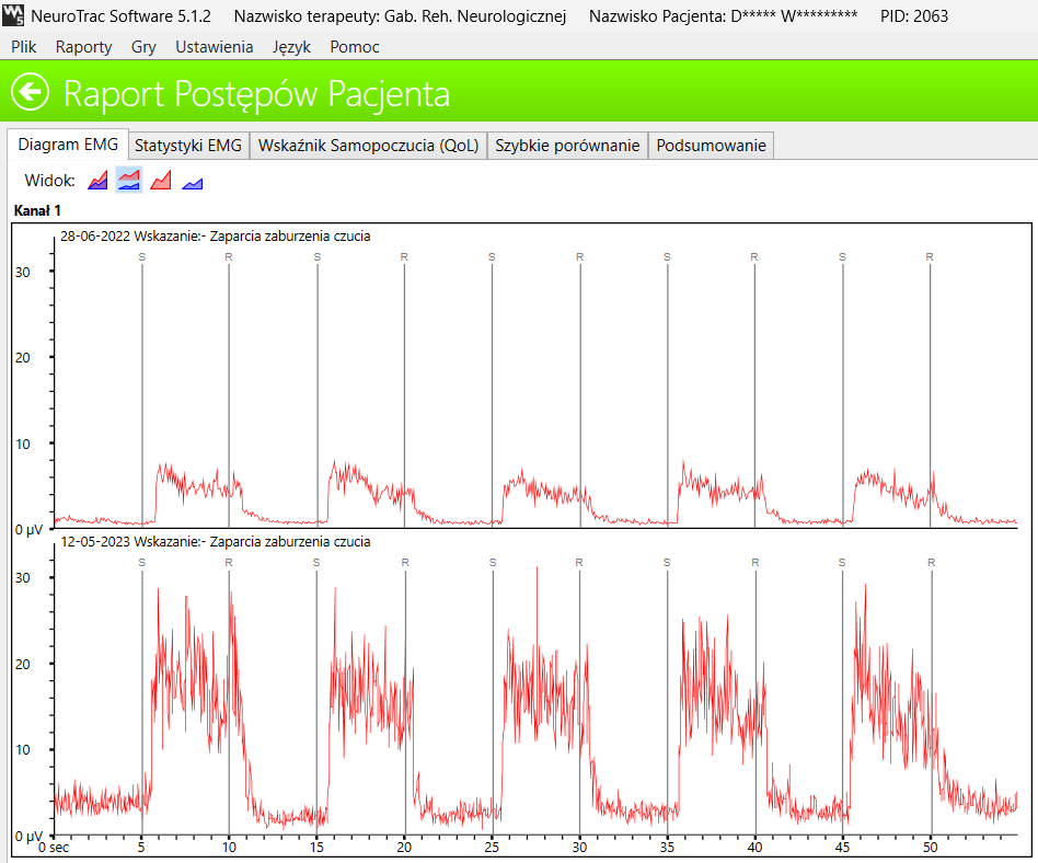 Raport postępów EMG - porównanie zdolności do generowania skurczu zwieraczy przed i po terapii domowej biofeedback, 4-krotny wzrost
