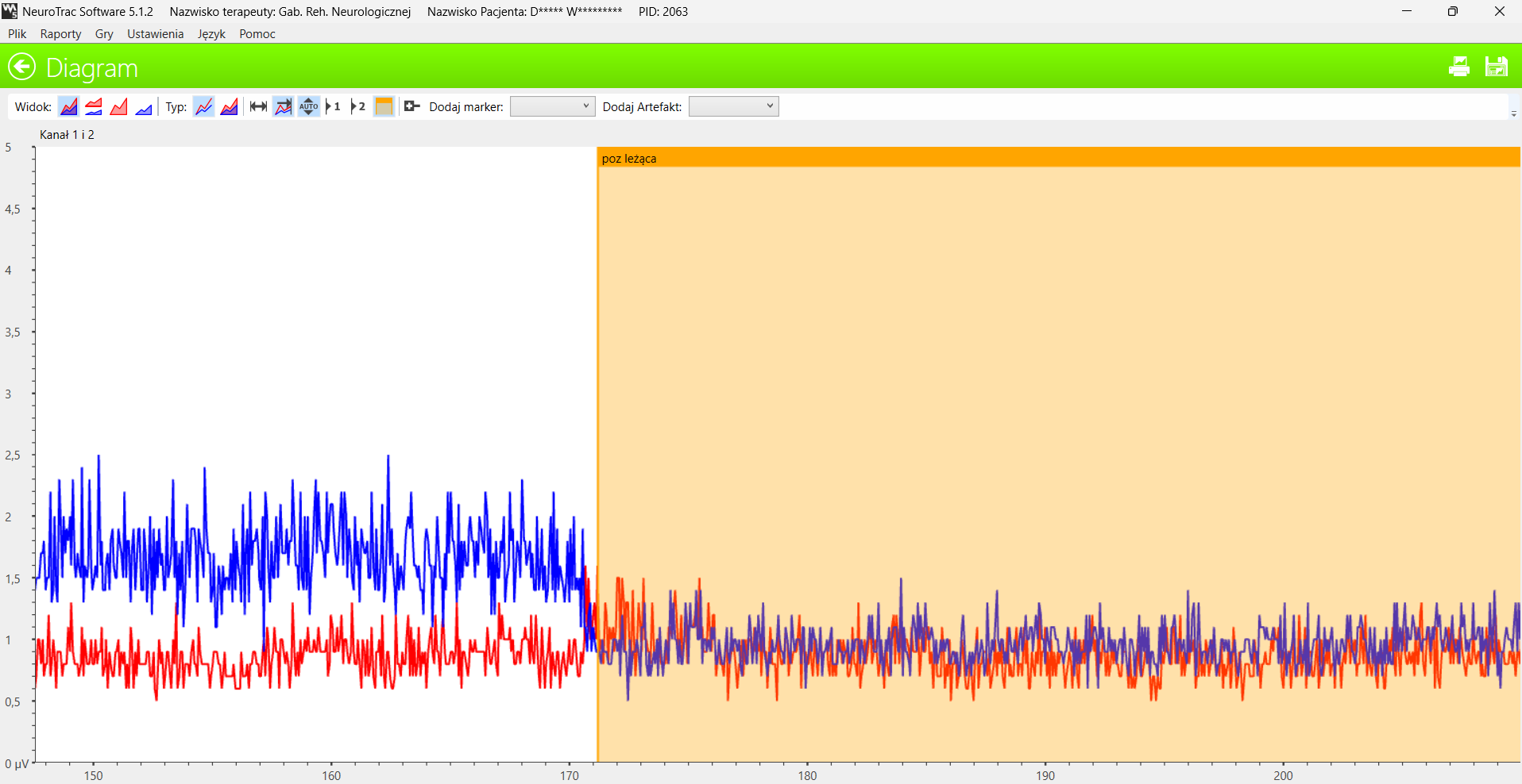 Wykres EMG napięcia spoczynkowego zwieraczy - wzmożone napięcie normalizuje się po zmianie pozycji kręgosłupa (zacieniony obszar)