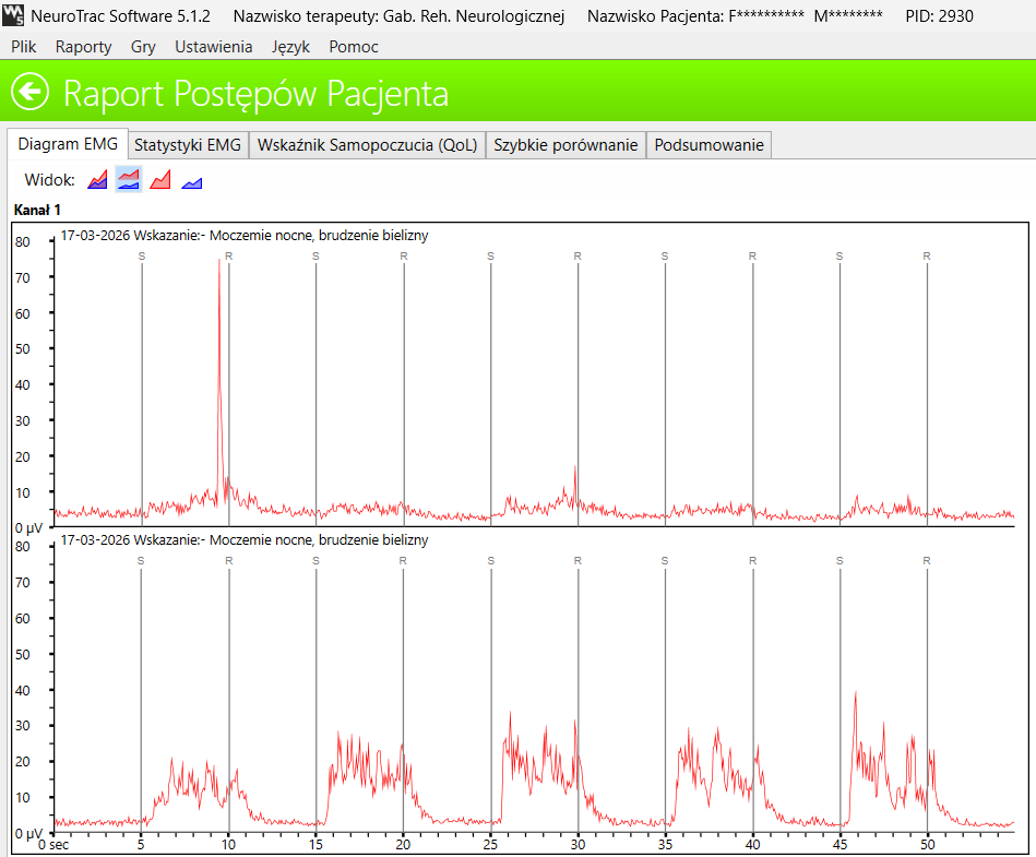 Raport postępów EMG - porównanie zdolności do generowania skurczu przed i po 15 minutach ćwiczeń biofeedback, ponad 3-krotny wzrost